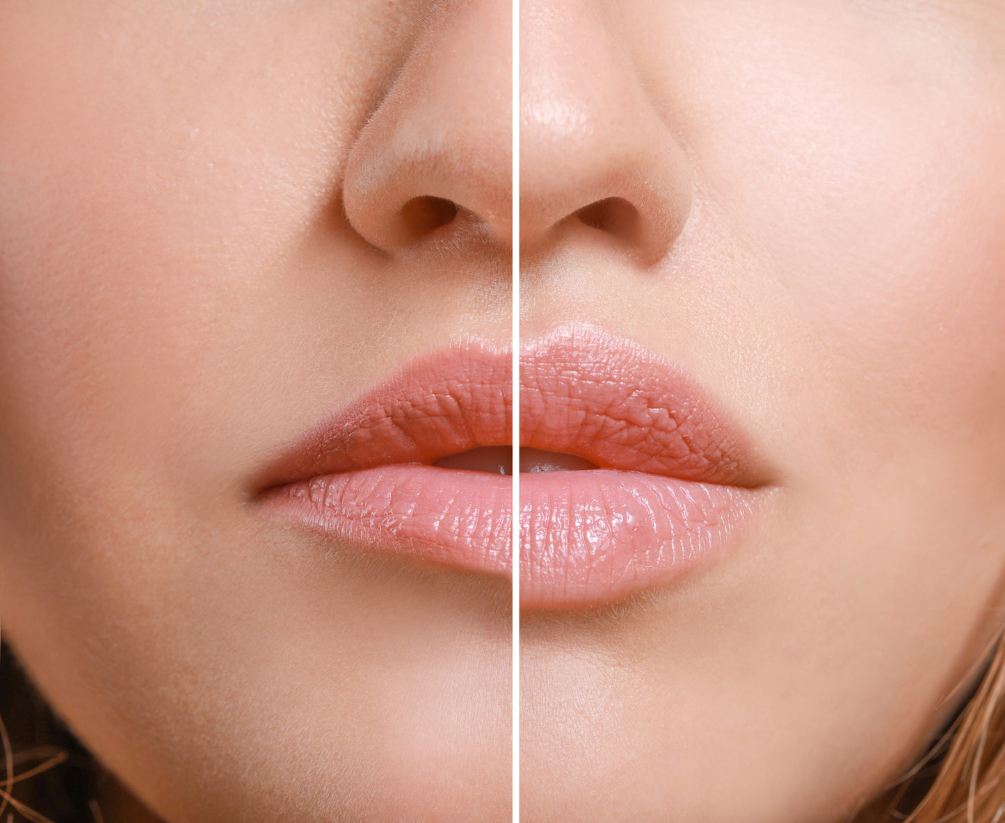 Rougj+ Lip Booster Effetto Rimpolpante